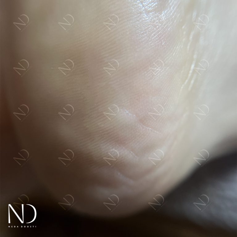 خدمات پدیکور ناخن